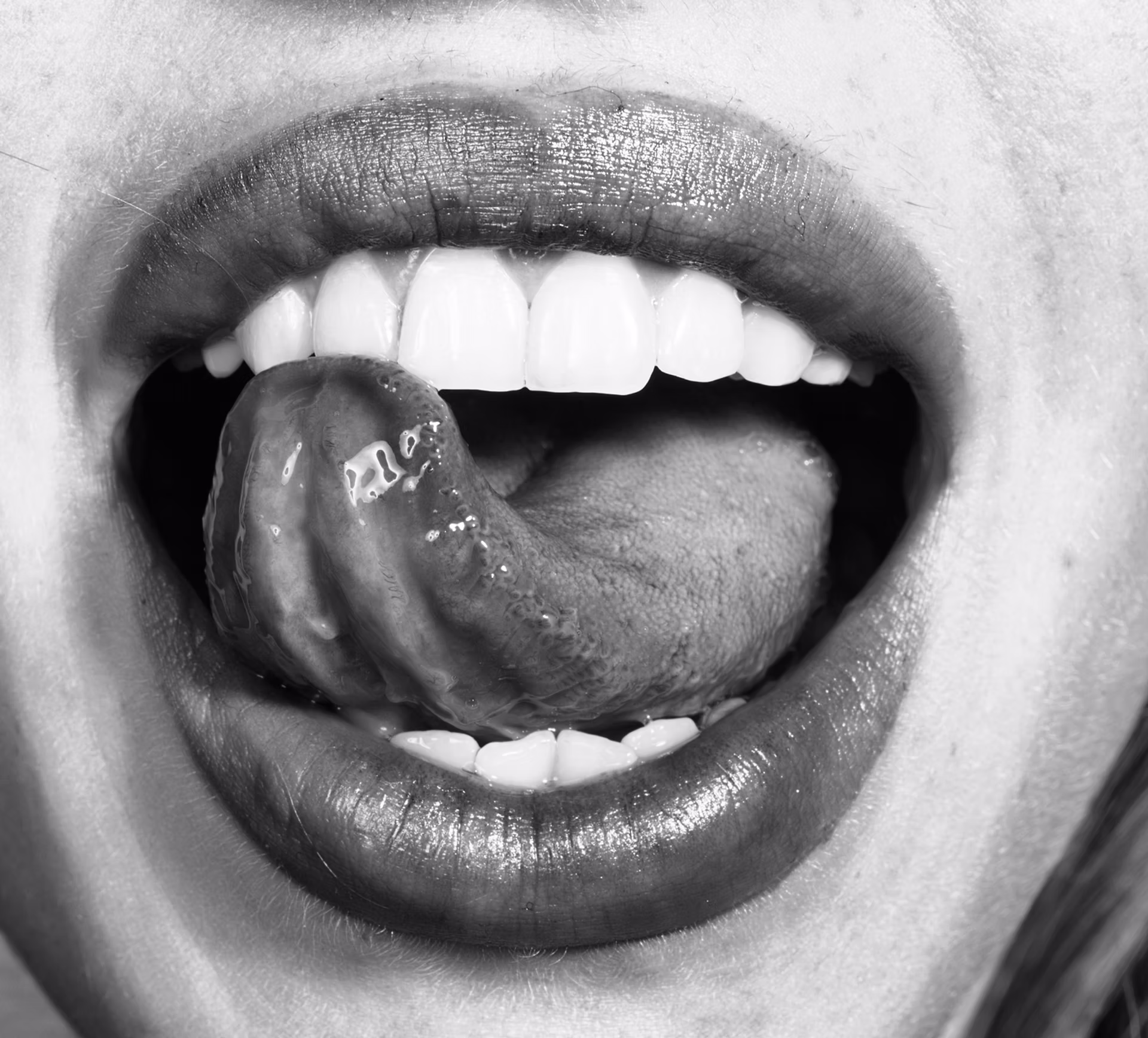 bad composite bonding