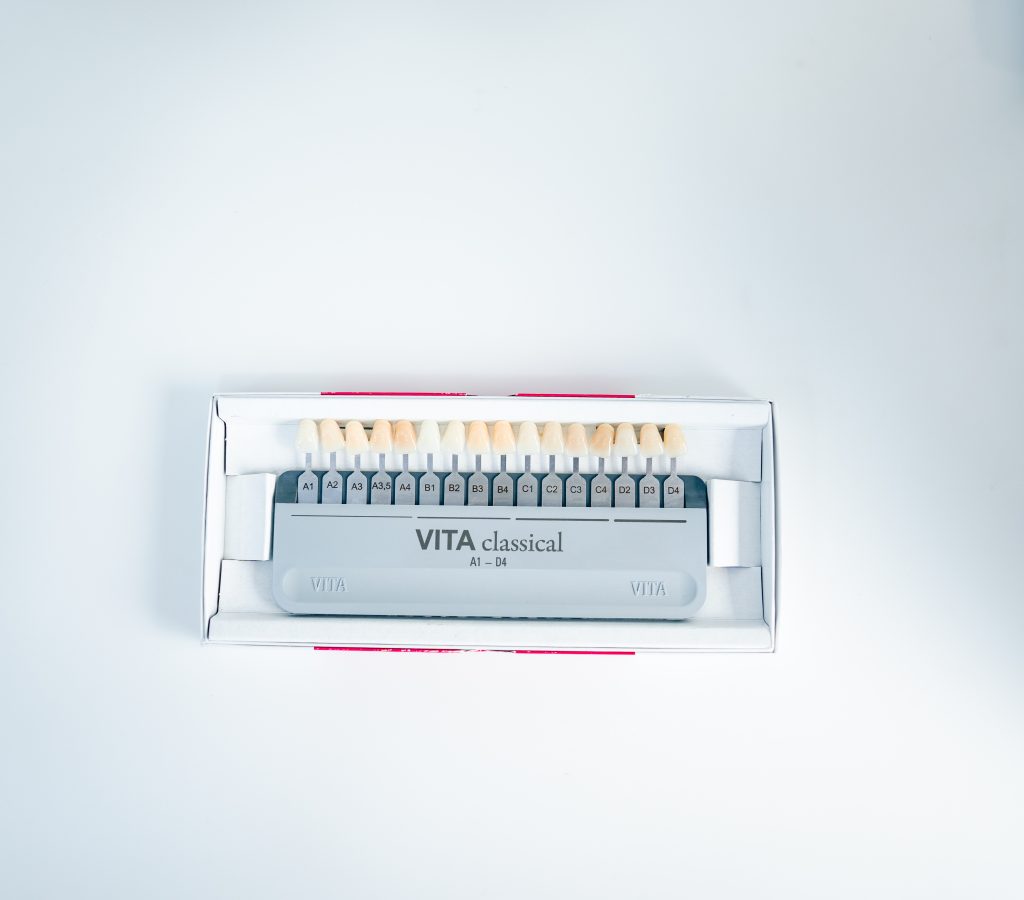 composite bonding vs veneers