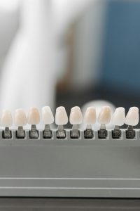 what happens to your teeth after veneers are removed?