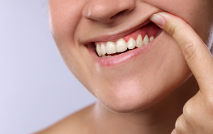 Person showing signs of gum disease